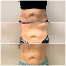 Load image into Gallery viewer, Body Sculpting: The Baddie Trio Special