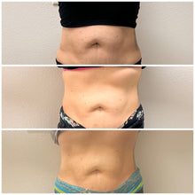 Load image into Gallery viewer, Body Sculpting: The Baddie Trio Special
